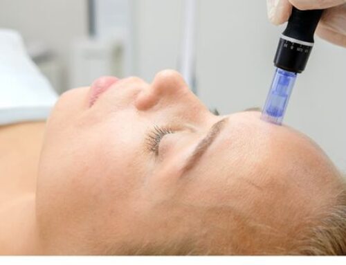 Microneedling: How It Works and Why It’s Effective