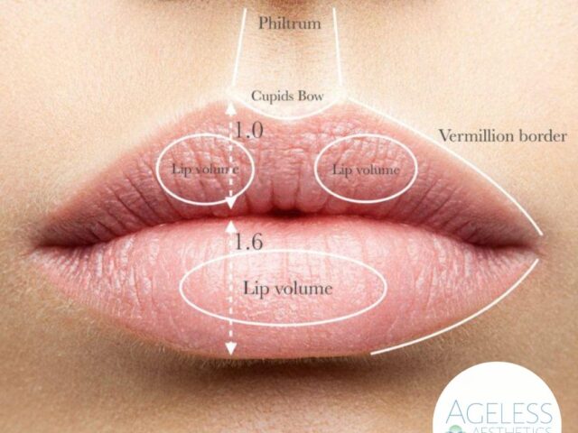 Lip Filler After Care