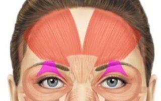 Highlights the location and activity of the Levator palpebrae superioris muscles that lifts the eyelids