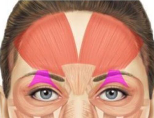 Droopy Eyelid after Botox: What causes it and how to fix it