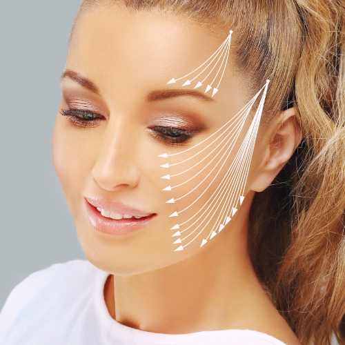 PDO thread lift treatment patterns A woman with a slight smile faces forward; white arrow lines on her cheek and temple illustrate the lifting directions of a thread lift, suggesting the use of PDO Threads for a cosmetic procedure or advanced skincare concept.