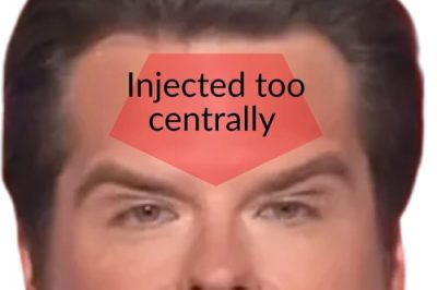 A man’s forehead with a red highlighted area labeled “Injected too centrally,” indicating a cosmetic injection issue.